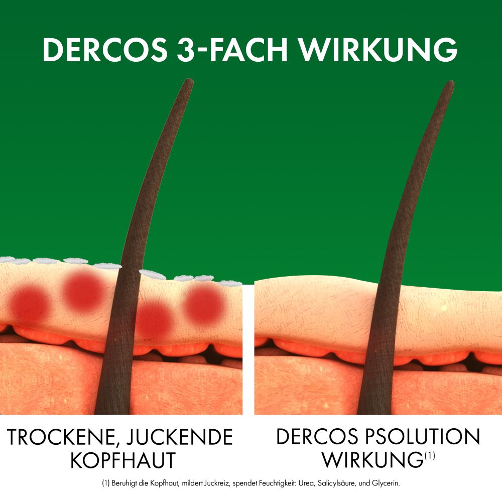 VICHY DERCOS PSOlution Kerato-Reduzierendes Pflegeshampoo  200 ml Shampoo