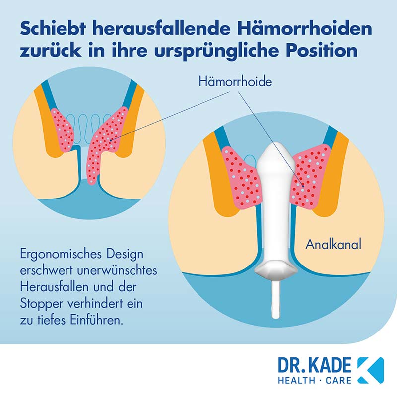 POSTERICARE Hämorrhoiden-Stick 1 St