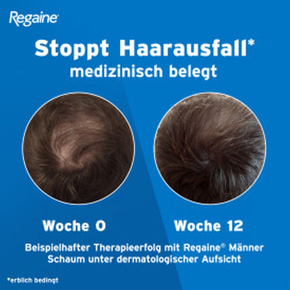 Regaine MÄNNER Lösung (3 Monats Packung) bei erblich bedingtem Haarausfall