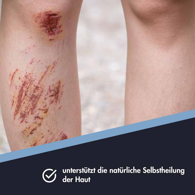 Zinksalbe Ensbona  75 ml Salbe