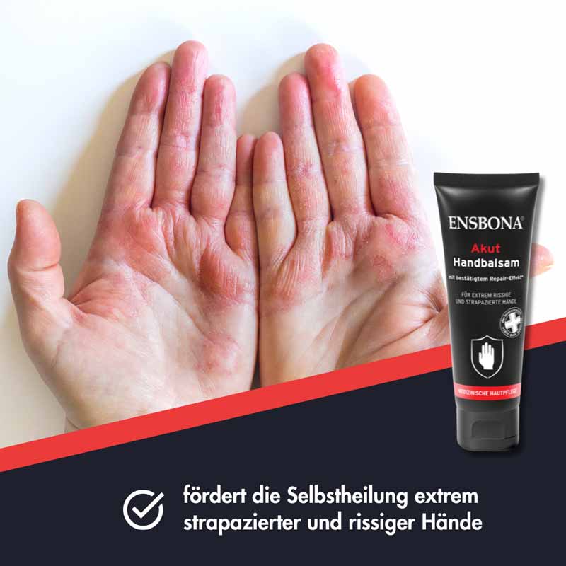 ENSBONA Akut Handbalsam 75 ml Balsam
