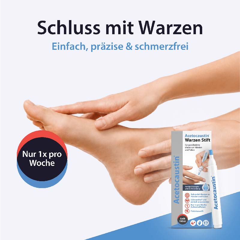 Acetocaustin Warzen Stift 3 ml Stifte