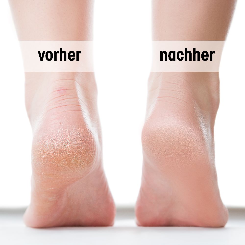 LASEPTONMED Fuß-Creme 75 ml Creme