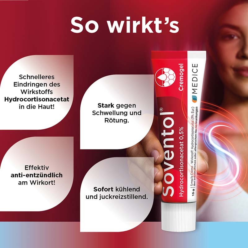 Soventol HydroCortisonACETAT 0,5% bei Hautentzündungen 30 g Creme