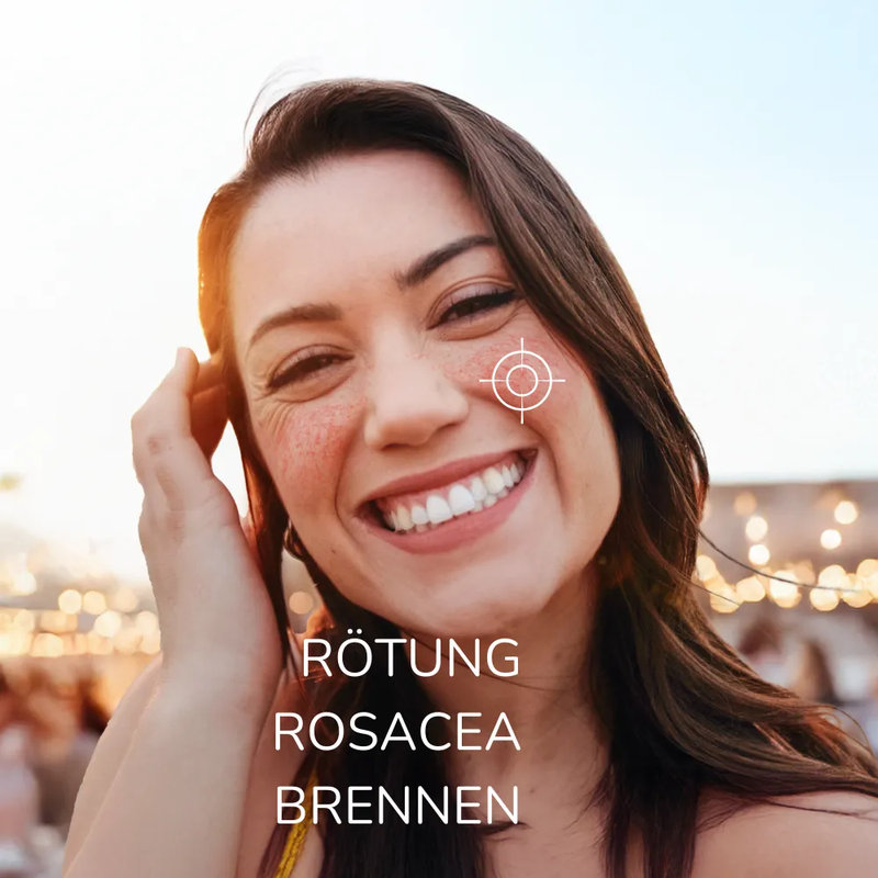Allergika Anti-Rötung Rosacea Creme MED 30 ml Creme