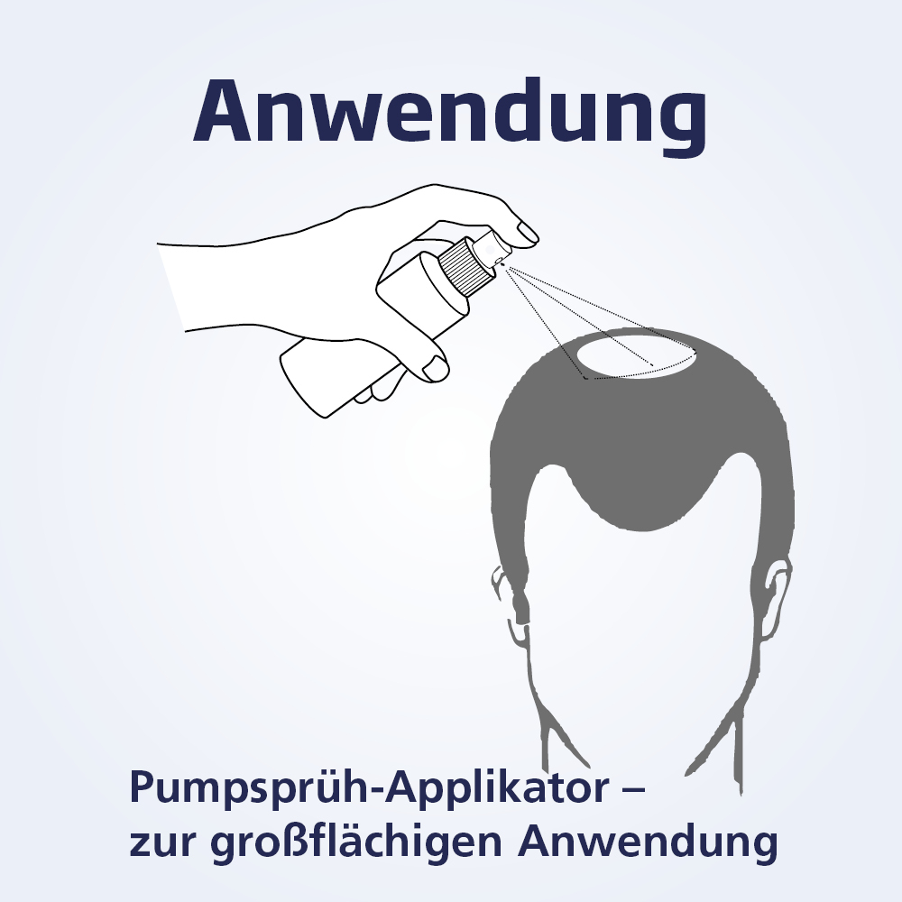 MINOXICUTAN Männer 50 mg/ml Spray 60 ml Lösung