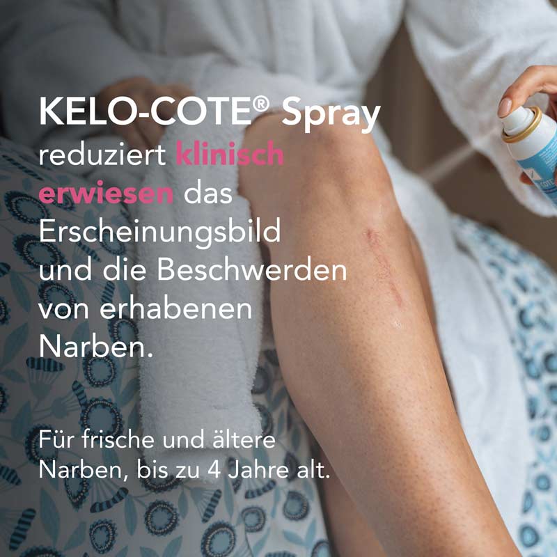 KELO-COTE Silikonspray 100 ml Spray