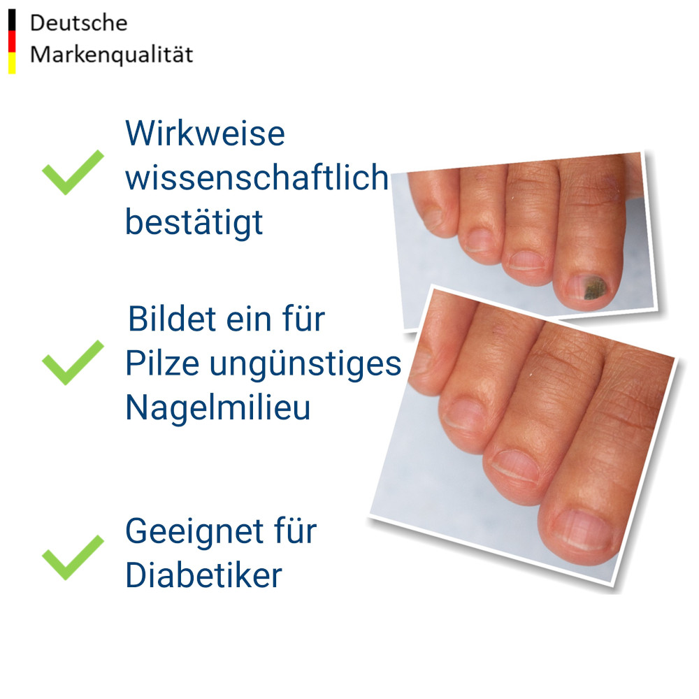 Evolsin Anti-Nagelpilz liquid 10 ml Tinktur