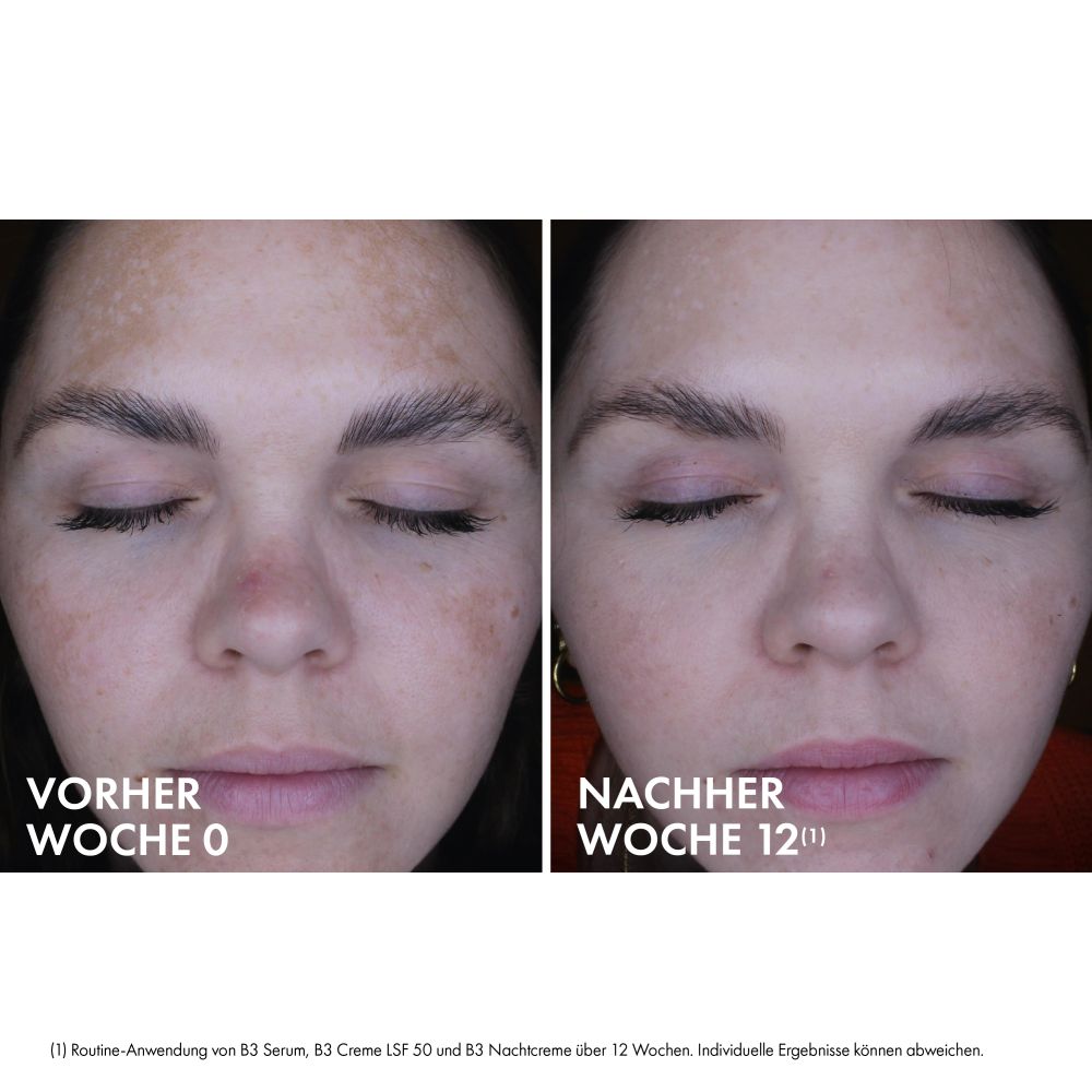 VICHY LIFTACTIV B3 ANTI-PIGMENTFLECKEN NACHT  50 ml Creme