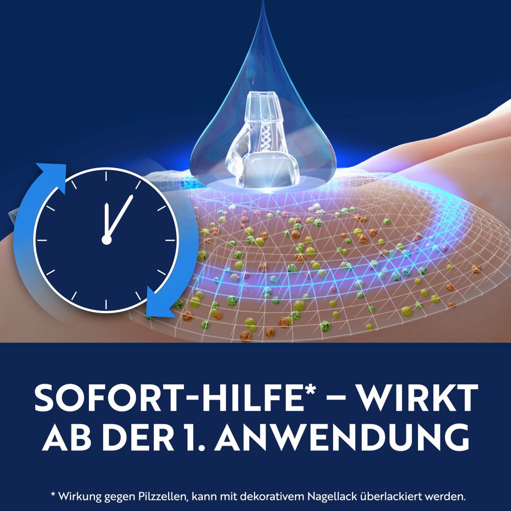 Loceryl Nagellack GEGEN NAGELPILZ DIREKT-Applikator 5 ml Wirkstoffhaltiger Nagellack