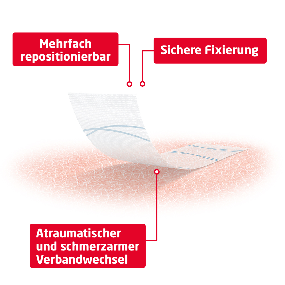 Fixomull skin sensitive Vollflächige Fixierung für die Sekundärfixierung 15 cm x 5 m 1 St Pflaster