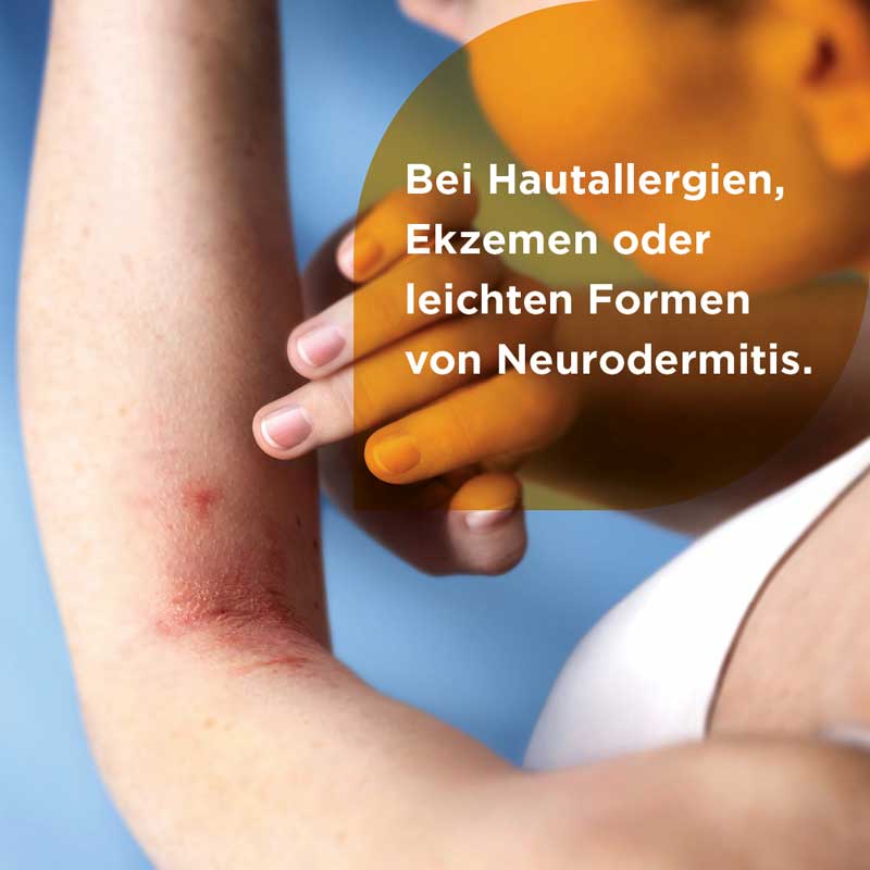Soventol HydroCort 0,5% bei akuten Hautentzündungen 15 g Creme