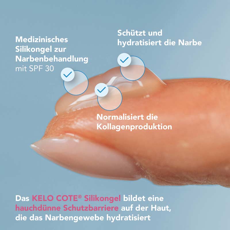 KELO COTE UV NARBENBEHANDLUNG SPF 30 15 g Gel