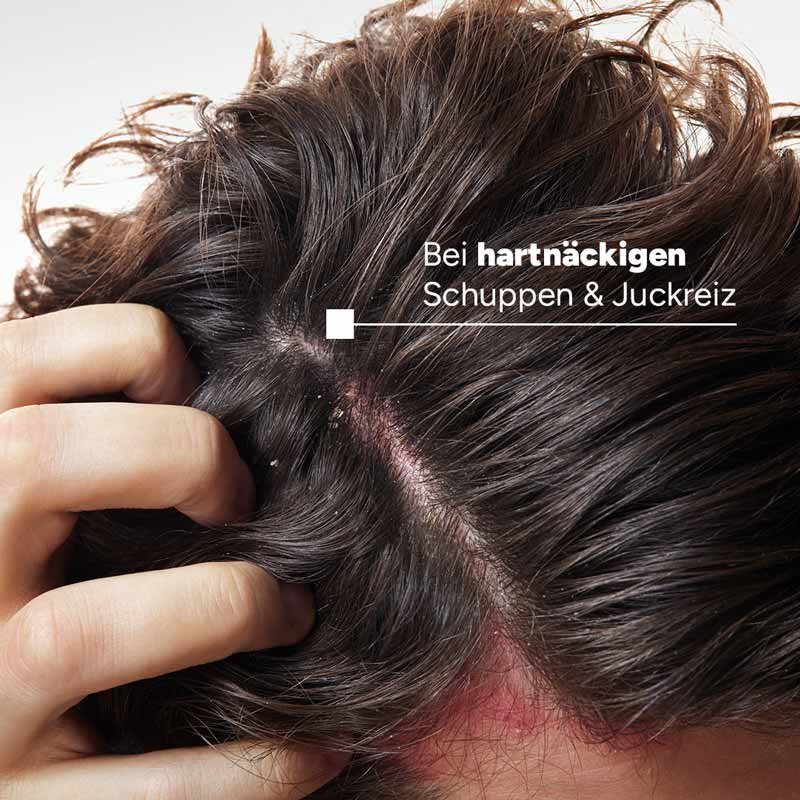 DUCRAY KELUAL ELUTION ANTI-SCHUPPEN BEGLEITPFLEGE-SHAMPOO 200 ml Shampoo