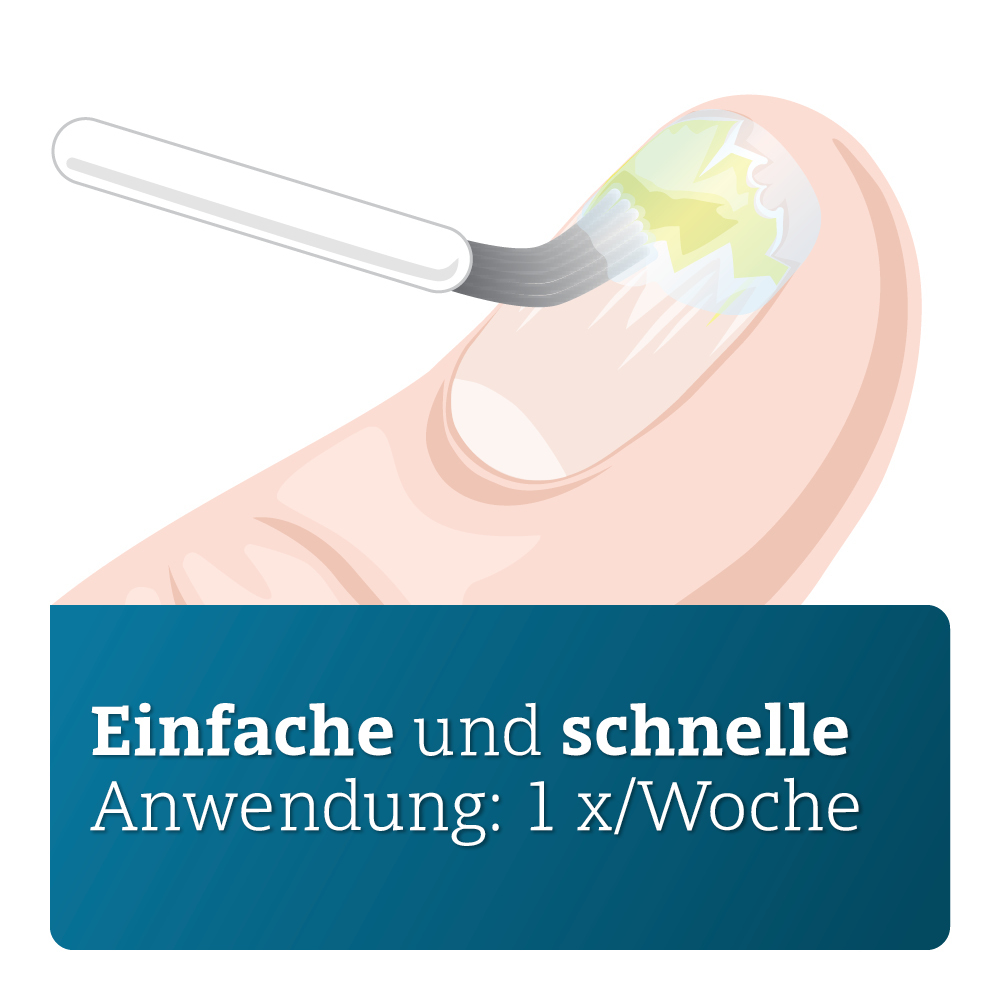 AMOROLFIN ADGC 50MG/ML 3 ml Wirkstoffhaltiger Nagellack