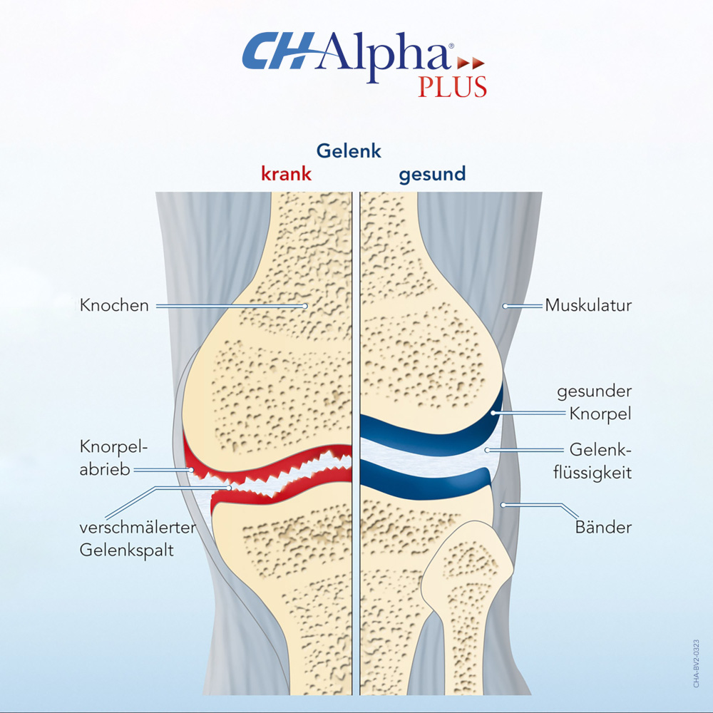 CH Alpha Gelenk-Gel 100 ml Gel