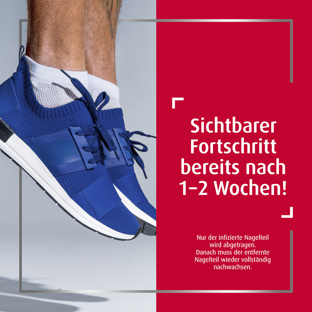 Canesten EXTRA Nagelset 1 St Salbe