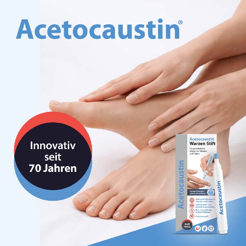 Acetocaustin Warzen Stift 3 ml Stifte