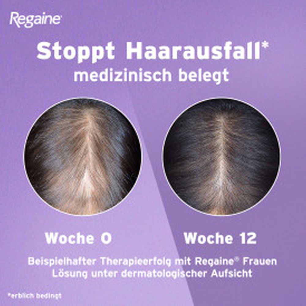 Regaine FRAUEN Lösung (3 Mon. Packung) bei erblich bedingtem Haarausfall