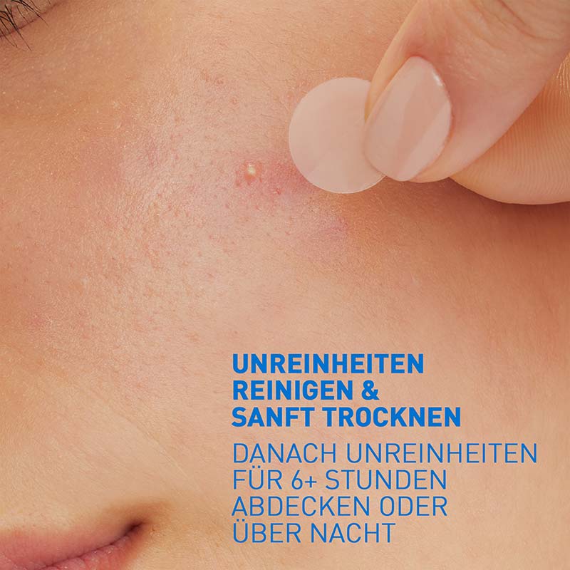 CeraVe Anti-Unreinheiten Patches 22 St Pflaster