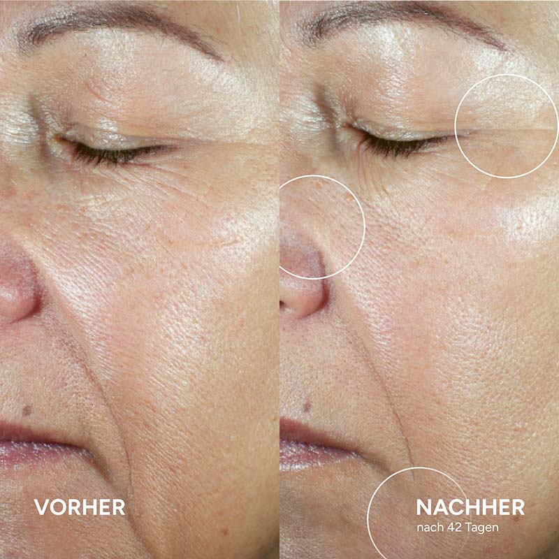 ANNEMARIE BÖRLIND ANTI-AGING SYSTEM ABSOLUTE 50 ml Flüssigkeit