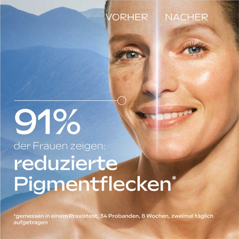 WELEDA ANTI-PIGMENTFLEFCKEN BRIGHT SERUM 30 ml