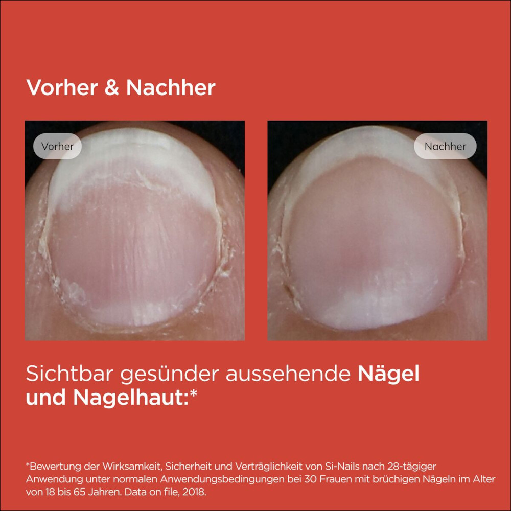 ISDIN SI-NAILS Nagelhärter 2.5 ml Stifte