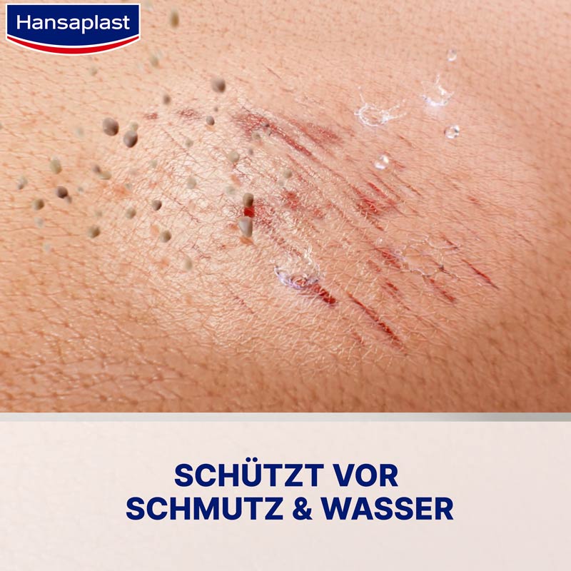 Hansaplast SPRÜHPFLASTER  40 ml Sprühflasche