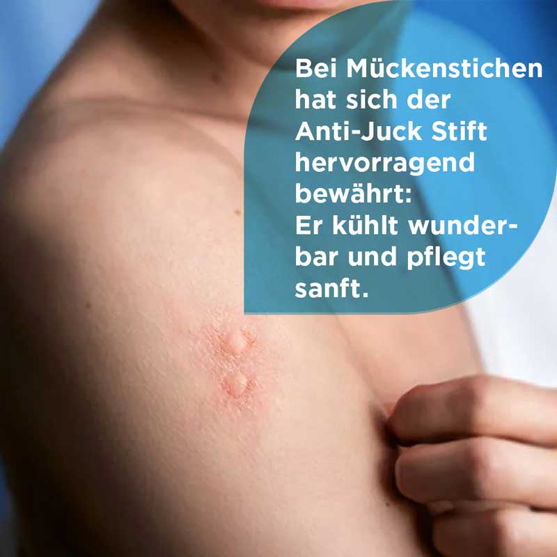 Soventol Anti-Juck Stift bei Insektenstichen 4 ml Gel