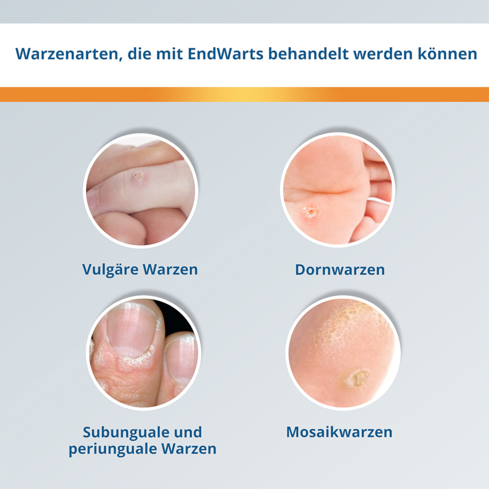 EndWarts CLASSIC  3 ml Lösung