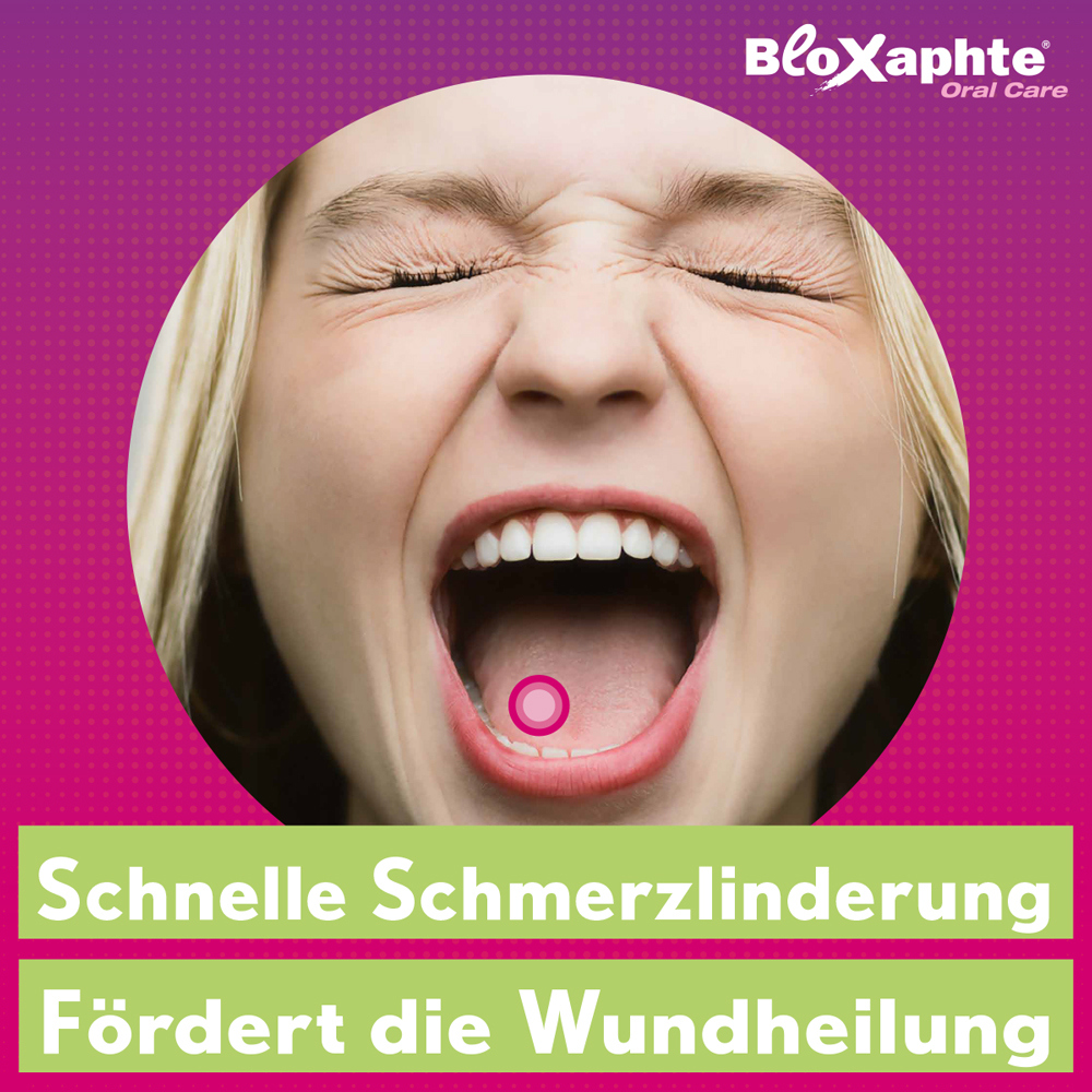 Bloxaphte Oral Care Mundspray bei Aphthen und Verletzungen im Mund 20 ml Spray