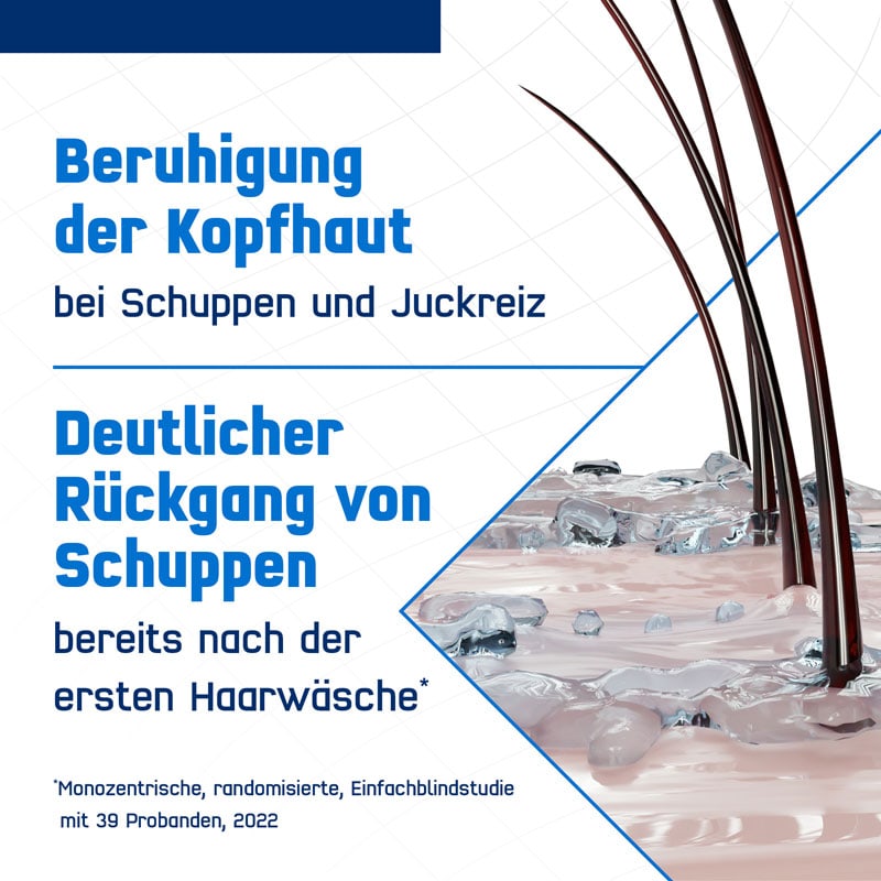 TERZOLIN Expert Schuppen-Shampoo bei fettiger Kopfhaut 200 ml Shampoo