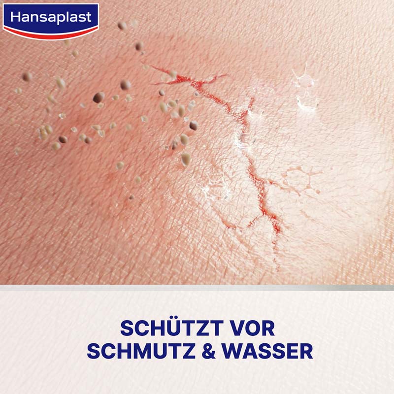 Hansaplast FLÜSSIGPFLASTER KONZENTRAT 10 ml Tube