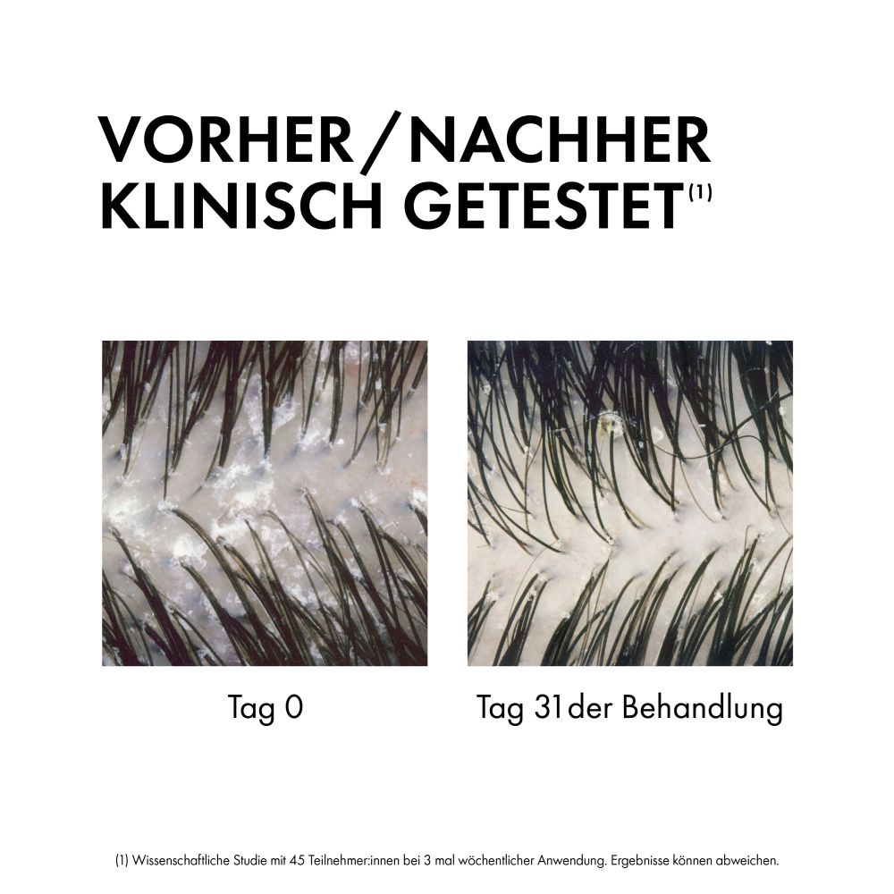 VICHY DERCOS Anti Schuppen 2in1 Shampoo + Conditioner 390 ml Shampoo