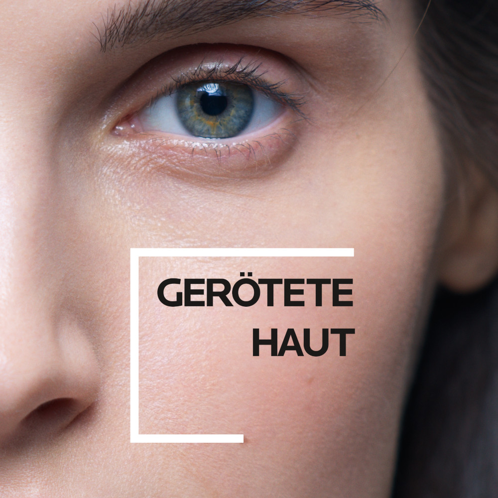 LA ROCHE-POSAY TOLERIANE ROSALIAC AR LSF30 TAGESPFLEGE 50 ml Creme