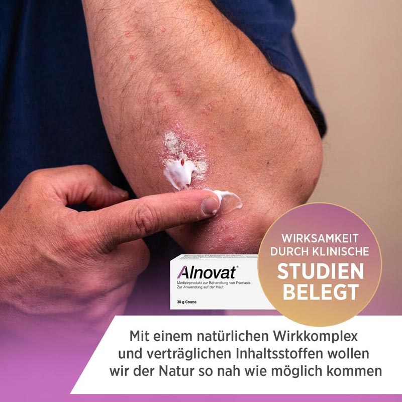 Alnovat 30 g Creme