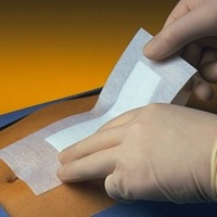 PRIMAPORE Wundverb.5x7,5 cm steril 100 St Verband