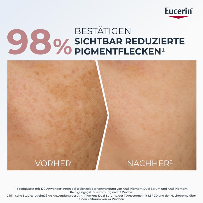 Eucerin ANTI PIGMENT DUAL SERUM 30 ml Creme