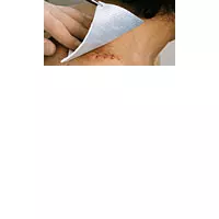 METALLINE Kompressen 10x20 cm steril 50 St Kompressen