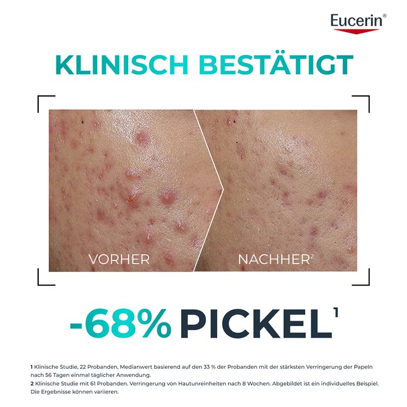 Eucerin DERMOPURE CLINICAL PROBIOM 8 1 St Creme
