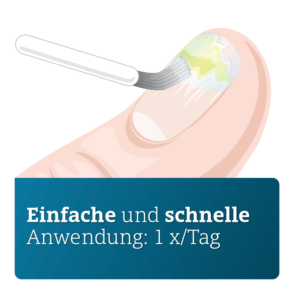 CICLOPIROX ADGC 80 mg/g Nagellack 6.6 ml Wirkstoffhaltiger Nagellack