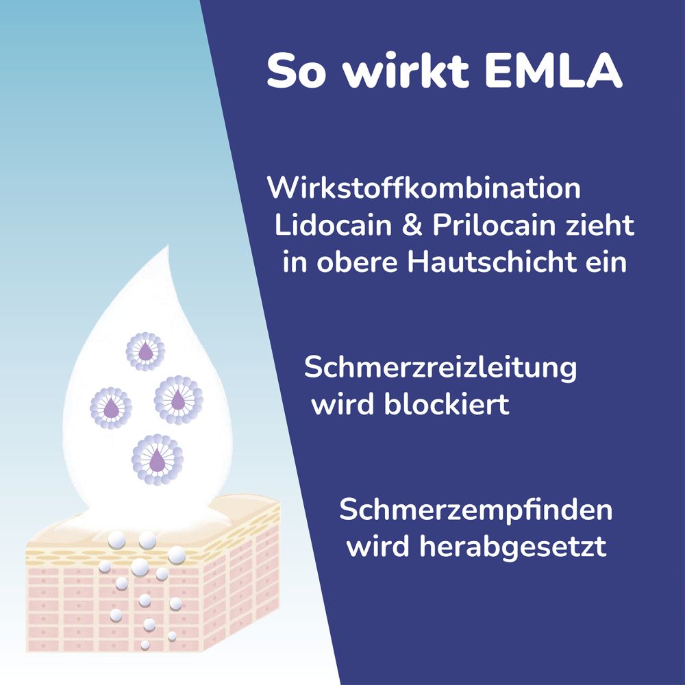 Emla 25 Mg/g + 25 Mg/g Creme 30 g Creme