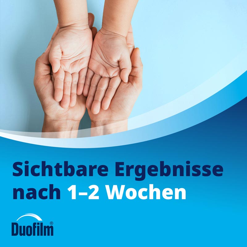 Duofilm 15 ml Lösung