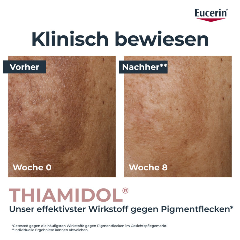 Eucerin ANTI PIGMENT TEINT PERFEKTIONIERENDES SERUM 30 ml Konzentrat