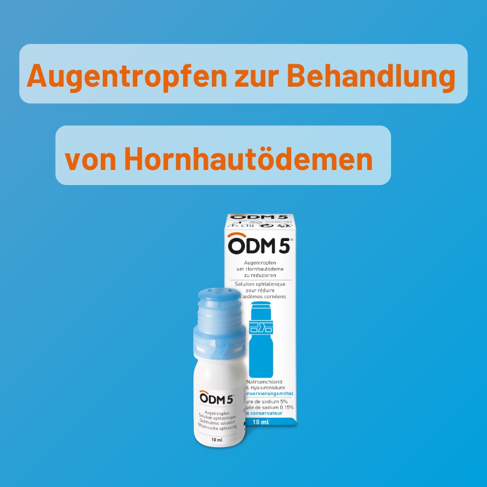 ODM 5 Augentropfen 1X10 ml Augentropfen