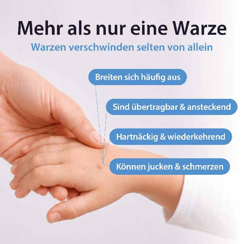 Acetocaustin Warzenmittel  2 ml Lösung
