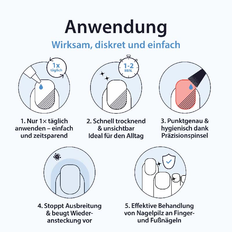 Acetocaustin Nagelpilz Lösung mit Aufhellung 9 ml Lösung