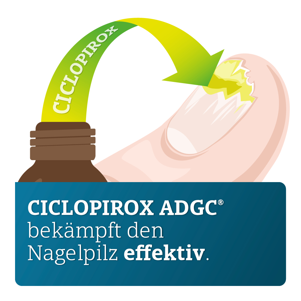 CICLOPIROX ADGC 80 mg/g Nagellack 6.6 ml Wirkstoffhaltiger Nagellack