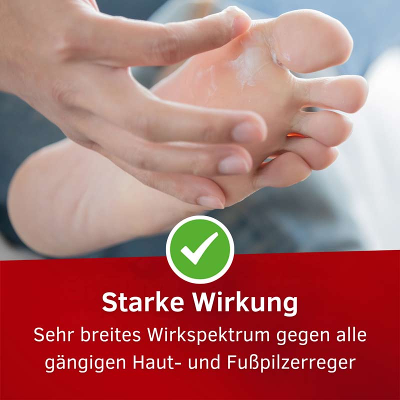 Mykosert Creme bei Haut- und Fußpilz 50 g Creme