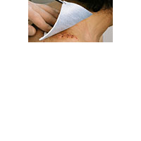 METALLINE Kompressen 8x10 cm steril 50 St Kompressen